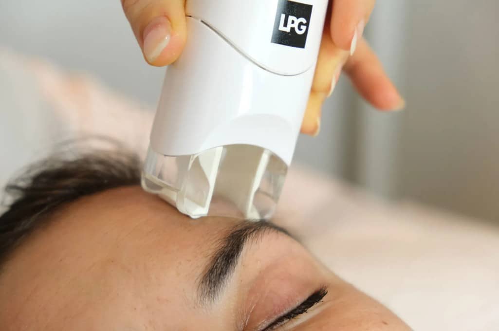 radiofrekvenca obraza 37